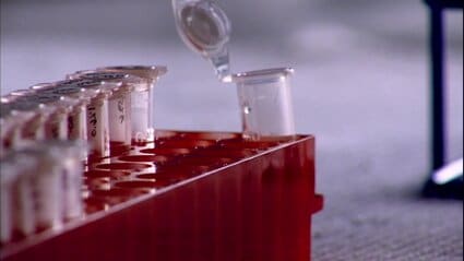 The Alzheimer's Project: Momentum in Science, Part 1 The Alzheimer's Project: Momentum in Science, Part 1