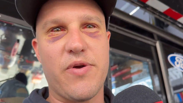 Preece shows off bruised eyes after scary Daytona flip